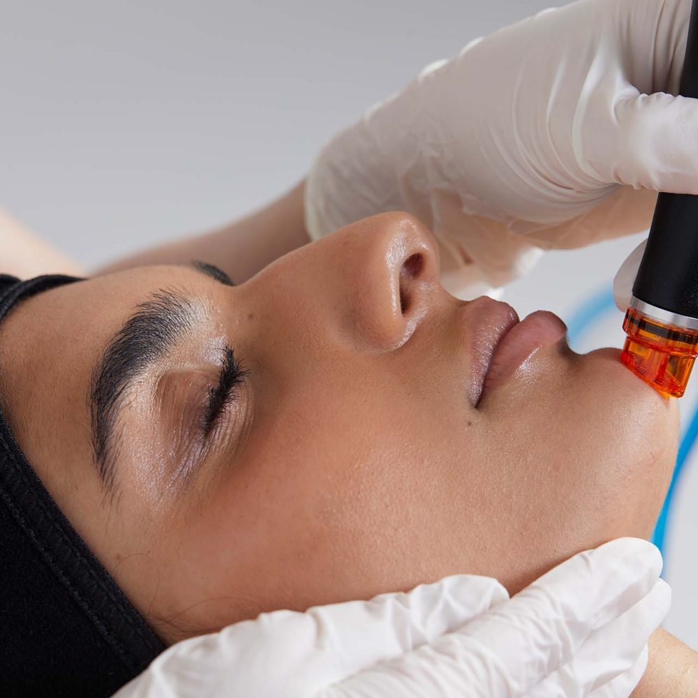 Ava_Treatment_Face_2497