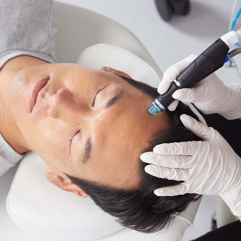 Matthew_Treatment_Face_2283